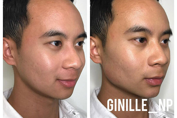 jawline-subpage-5 jawline-subpage-5